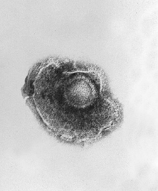 Snímek viru varicella-zoster